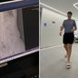 Exame de raio-X mostra a aliança engolida acidentalmente por Pedro Nogueira, de 20 anos, durante uma brincadeira em Santos - Imagem: Arquivo pessoal/Reprodução